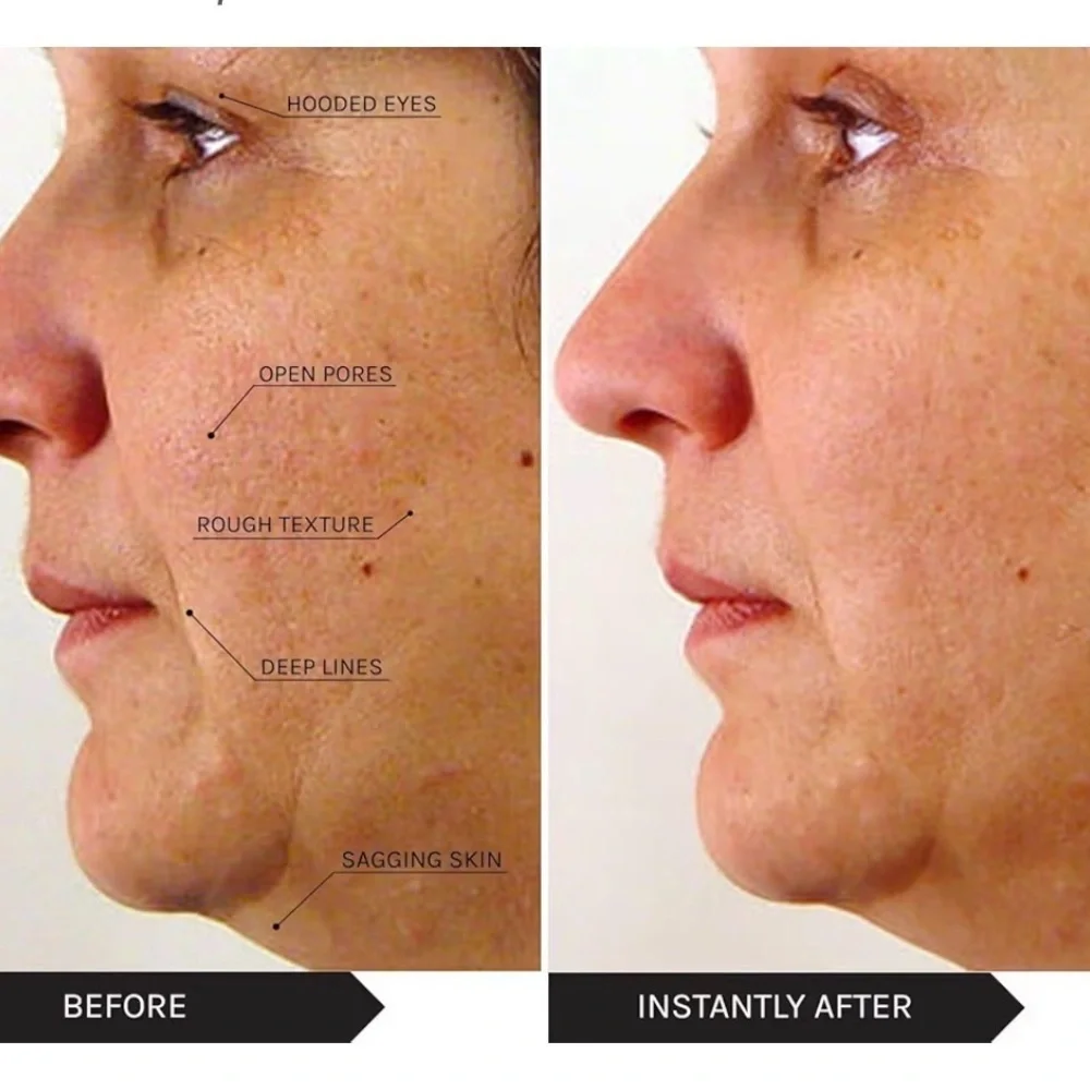 Power Lift Treatment Cream - White